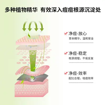 草本高端祛痘膏去青春痘粉刺闭口男女通用温和淡化痘印痘坑祛痘霜