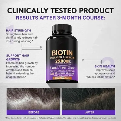 Biotin Collagen Keratin Hair Growth Capsules - 5