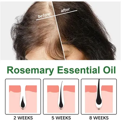 EELHOE Rosemary Hair Care Oil, Moisturizes Scalp and Smooths Hair
