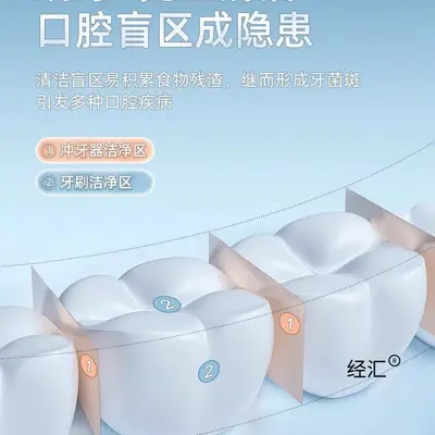 超声波冲牙器家用便携式洗牙器洁牙器水牙线正畸专用