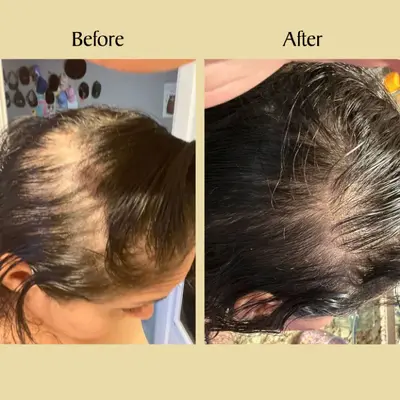 跨境爆款Natural Hair Growth Oil Veganic头发营养液育发油防脱