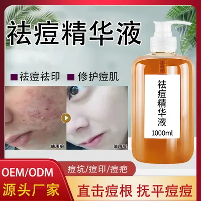 Acne-clearing essence for fading marks and pore refinement
