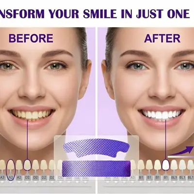 Purple Teeth Whitening Strips V34 Set, Yellowing Removal - 4