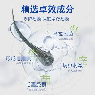 煤焦油洗剂官方旗舰店正品头痒抑菌洗液脂溢性去头油头屑炎洗剂水