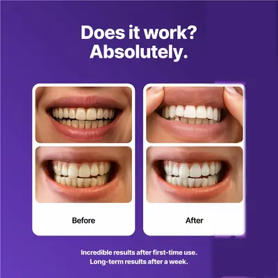 跨境dr dent purple teeth whitening牙贴呵护牙釉质层牙贴可定制