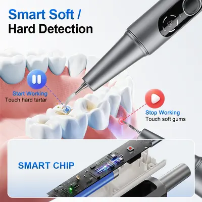 超声波洁牙器便携电动洗牙器5种模式可视超声波洁牙器去除牙结石