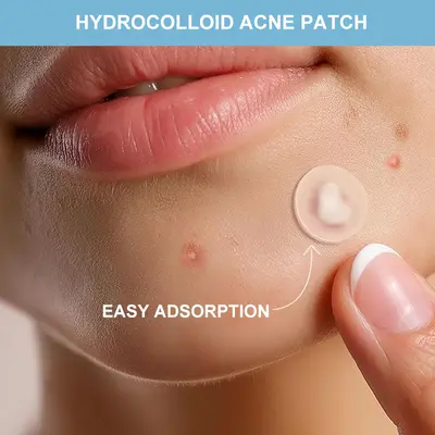 Hidrokolloid sivilce bandı, çay ağacı yağlı, 36 adet - 5