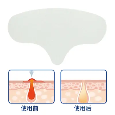 Invisible Forehead and Nose Strips, Peel-Off T-Zone Pore Care - 7
