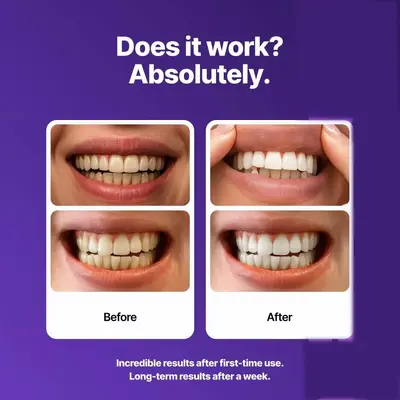 Dr Dent Diş Beyazlatma Bandı, Mor - 4