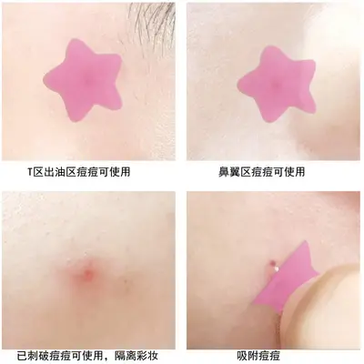 Star Pimple Patch, Hydrocolloid Fluid-Absorbing, Invisible, Makeup-Compatible - 3
