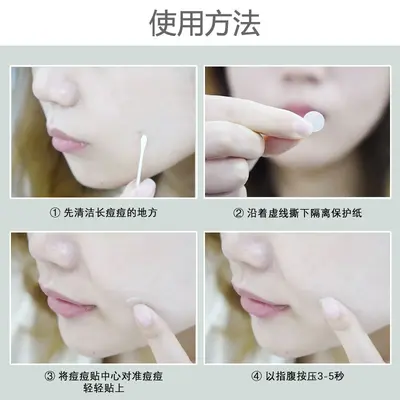 Transparent Hydrocolloid Acne Patches, 36 Pcs - 5