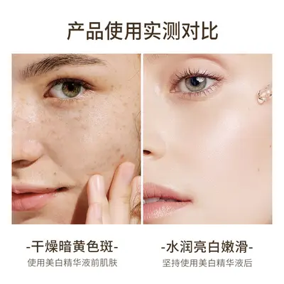Skin Whitening and Freckle Removal Essence Niacinamide Freckle Removal Moisturizing and Renewal Smooth Skin Brightening Skin Essence Essence - 4