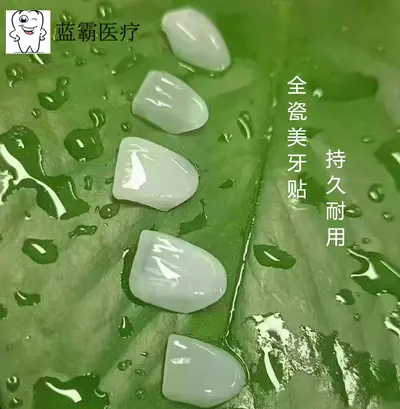 全瓷美牙贴面 牙齿贴片全瓷贴片私人美牙贴冰瓷蓝瓷琥珀瓷贴片
