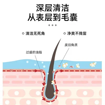 二硫化硒洗发水液控油蓬松去屑止痒头皮毛囊除清螨洁炎洗发露男女