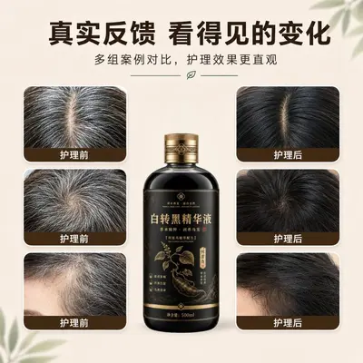 白转黑精华液乌黑滋养液滋养毛囊坚韧发根育发液防脱膏何首乌草本 - 4