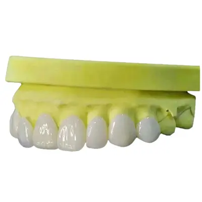 Yiohjia All-Ceramic Dental Veneer Porcelain Laminate, Blue Ceramic, Amber Ceramic, Lingxi Ceramic, Handmade Porcelain, Fluorosis Teeth Whitening Teeth - 6