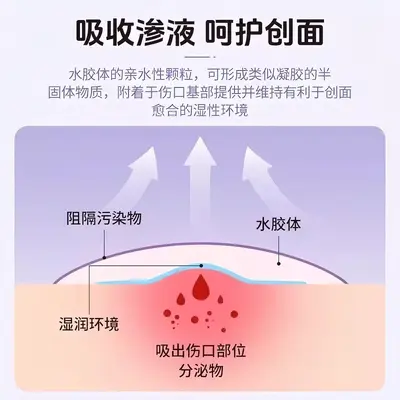 星星痘痘贴型遮盖痘印隐形可上妆防汗水可爱物理吸脓水胶体痘印贴