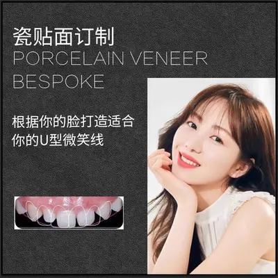 Full Porcelain Dental Veneers, Domestic Porcelain Tooth Veneer Patches - 3