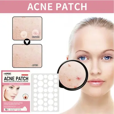 Ultra-Thin Invisible Acne Patches, Acne Mark Concealing, Strong Absorbing - 3