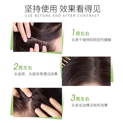 Anti-Dandruff Oil-Control Shampoo for Salons, 750ml - 4