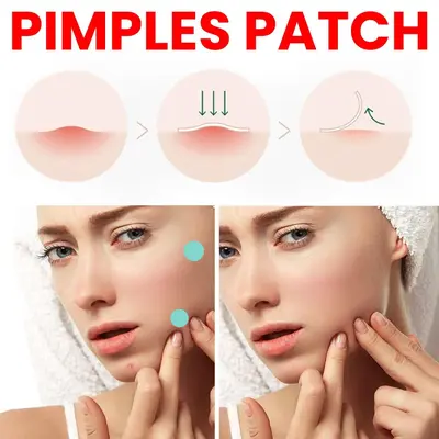 Pimples patch yuvarlak renkli hidrokolloid yaması