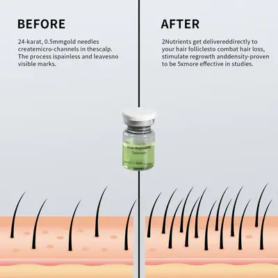 Infuse Hair Regrowth System Mikroiğneli Saç Serumu, Yoğunlaştırıcı - 3