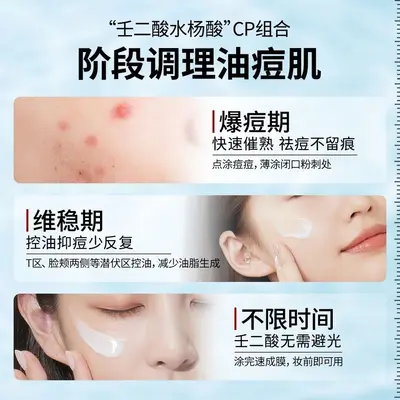 华箐专研水杨酸壬二酸凝胶淡化痘印痘坑黑头粉刺滋润呵护肌肤批发