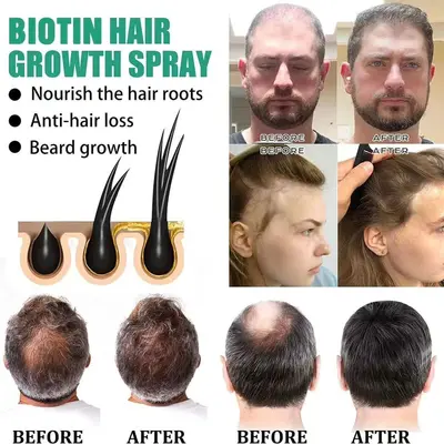RALU Anti-Haarausfall-Serum mit pflanzlichen Extrakten - 4