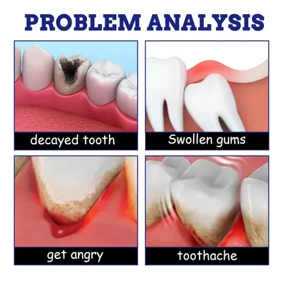 SouthMoon oral care spray relieves tooth discomfort