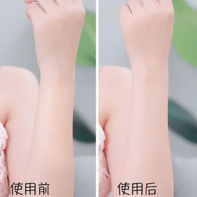 Face Lifting and Facial Hair Remover Epilator