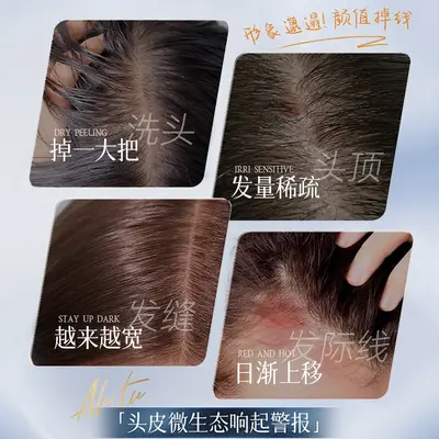 Sushouchen Anti-Haarbruch-Essenz für trockenes Haar - 3