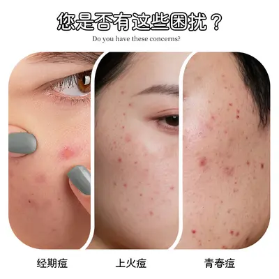 PE Acne Patches Cute Letter Design 40 Pieces - 2