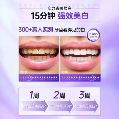 色修美白牙贴去黄洁白强效去黄牙齿变白强效贴片一次性光感亮白牙