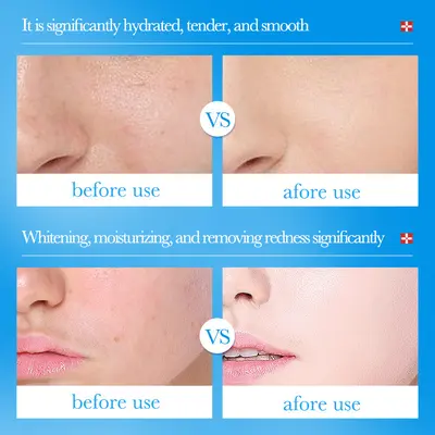 BIOAOUA Vitamin B5 Hyaluronik Asit Yatıştırıcı Onarıcı Serum