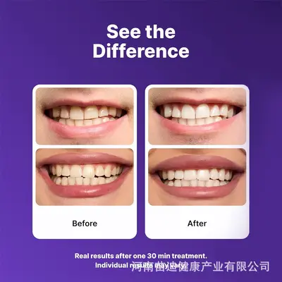 V34 Purple Teeth Whitening Strips, 14 Pcs (7 Pairs)