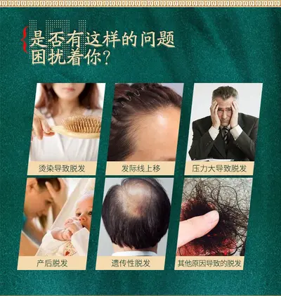 Zhangguang 101 Scalp Essence Hair Growth Agent Scalp Nourishing Solution Strengthens Roots Healthy Hair Nourishing Hair Growth Liquid Genuine Product