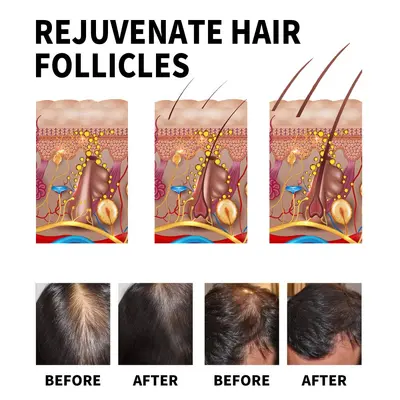 Jaysuing Scalp Care Oil Serum, Moisturizing Scalp Essence for Scalp Massage