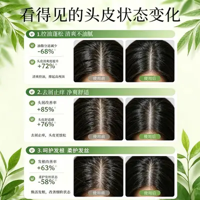 角蛋白生姜侧柏叶洗发水控油蓬松去屑止痒柔顺留香洗发露