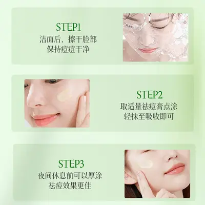 AOPY Herbal Acne Cream, Gentle Formula, for Men and Women