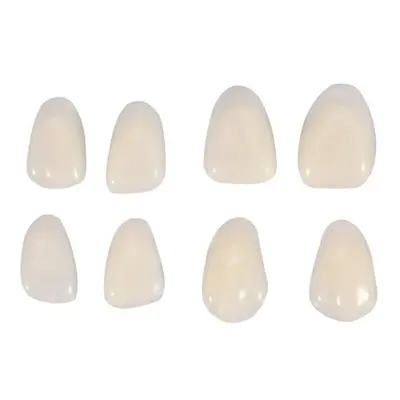 Zahnveneers A1 A2, provisorische Zahnschalen - 4