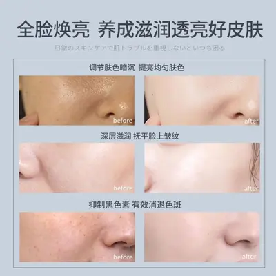 Salmon Hyaluronic Acid and Tranexamic Acid Hydrating Serum