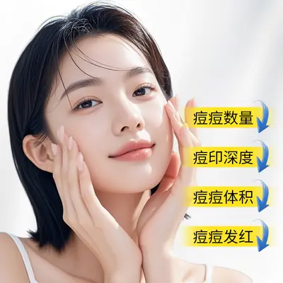 兰色素心控油祛痘精华液淡化痘印修护痘坑痘疤小灯泡去闭口精华液
