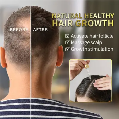 Biotin Hair Growth Essential Oil for Scalp, Beard and Eyebrows