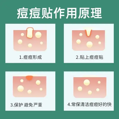 Invisible Hydrocolloid Pimple Patch, Makeup-Compatible - 4