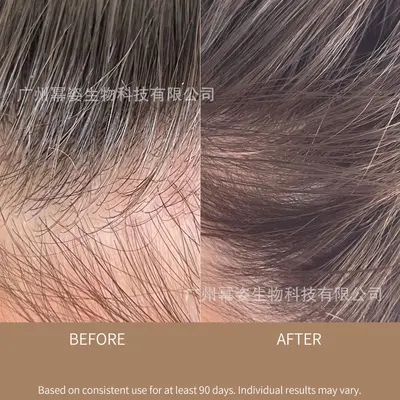 Saç Bakım Yağı Besleyici Rahatlık Veren Frizz Önleyici