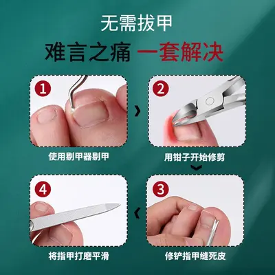 修脚刀套装专业技师用甲沟指甲钳灰指甲剪去死皮老茧脚趾甲全套炎