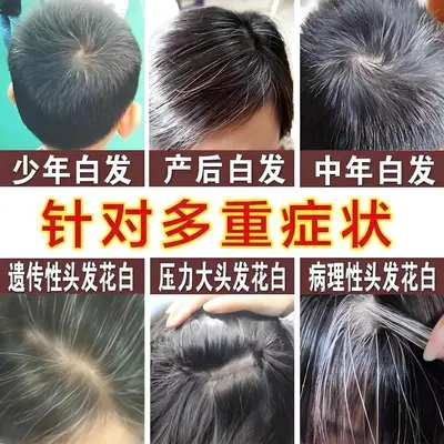 白转黑乌黑滋养液精华液滋养毛囊坚韧发根育发防脱发何首乌育发液 - 3