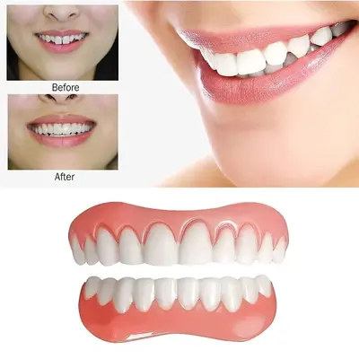 DIYcos Silicone Simulated Teeth Veneers, Stage Props - 2