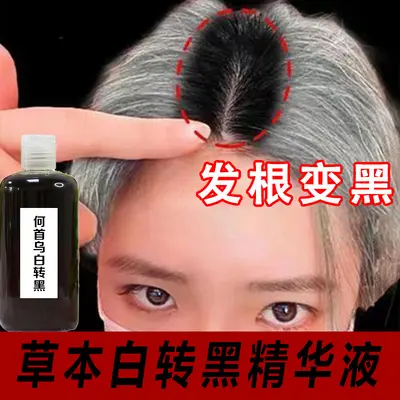 何首乌白转黑精华液白发转黑发营养液滋养毛囊养发护发防脱育发液 - 2