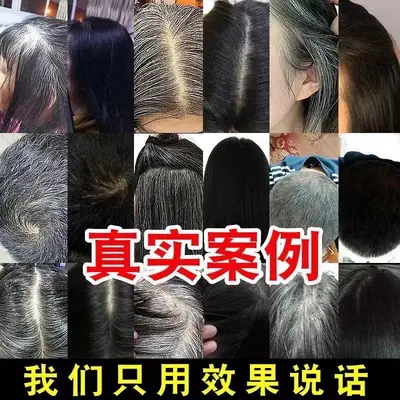 何首乌白转黑精华液白发转黑发营养液滋养毛囊养发护发防脱育发液